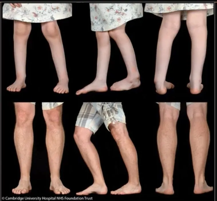 Slide 1 — clinical appearance of lower-limb deformities