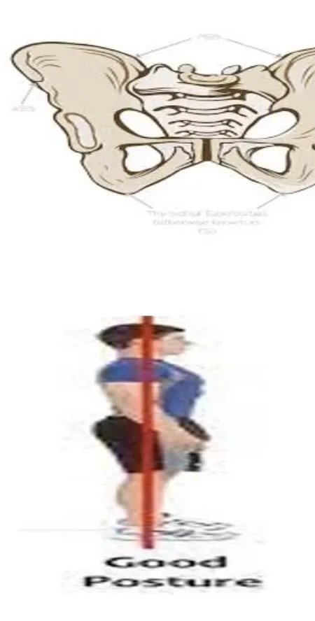 Slide 14 — normal pelvic alignment and plumb line