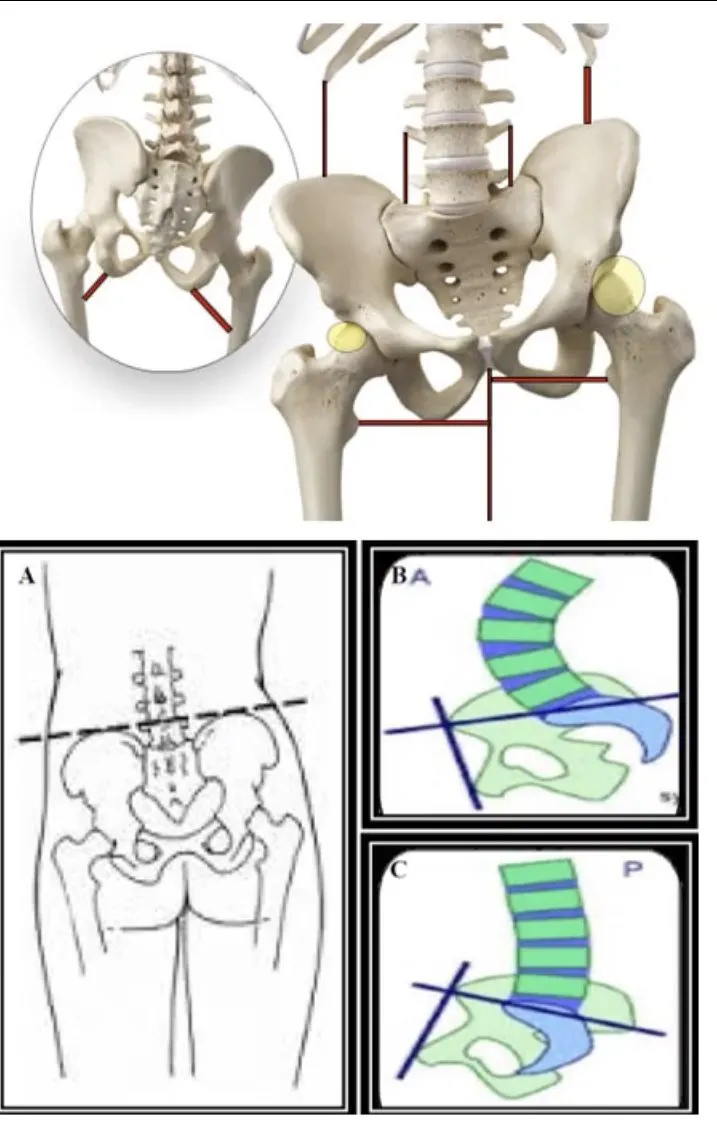 Slide 15 — lateral tilt (A); anterior (B) and posterior (C) pelvic tilt