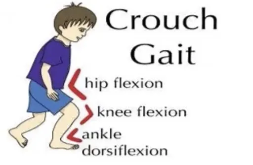 Slide 21 — crouch gait