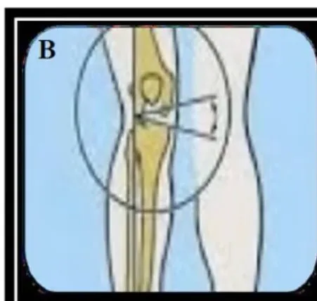 Slide 26 — mechanical axis displaced laterally