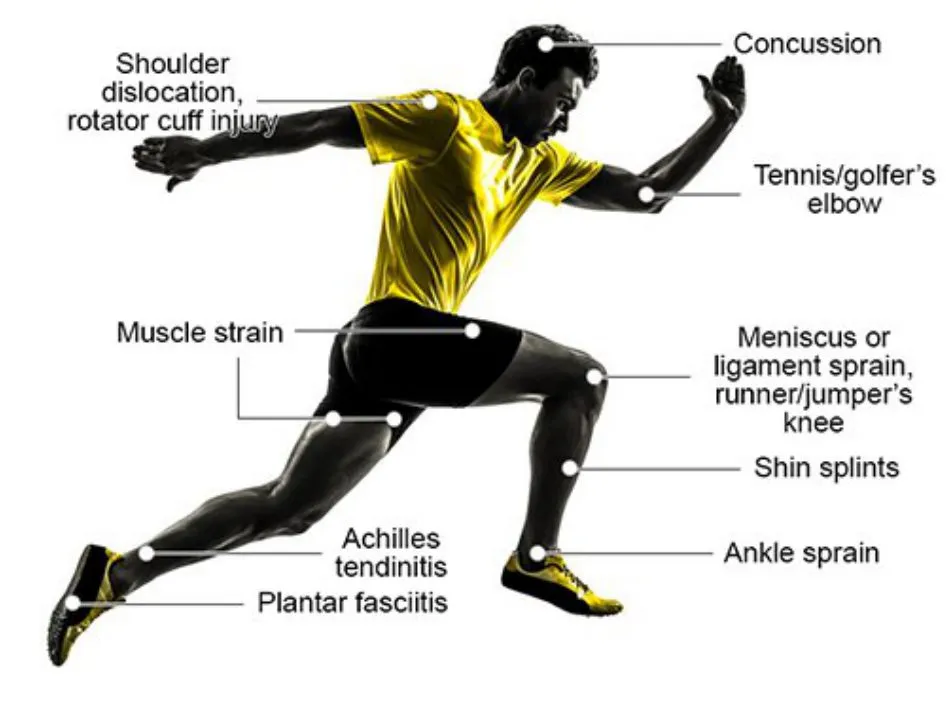 Slide 2 — common injuries labelled on the title-slide figure