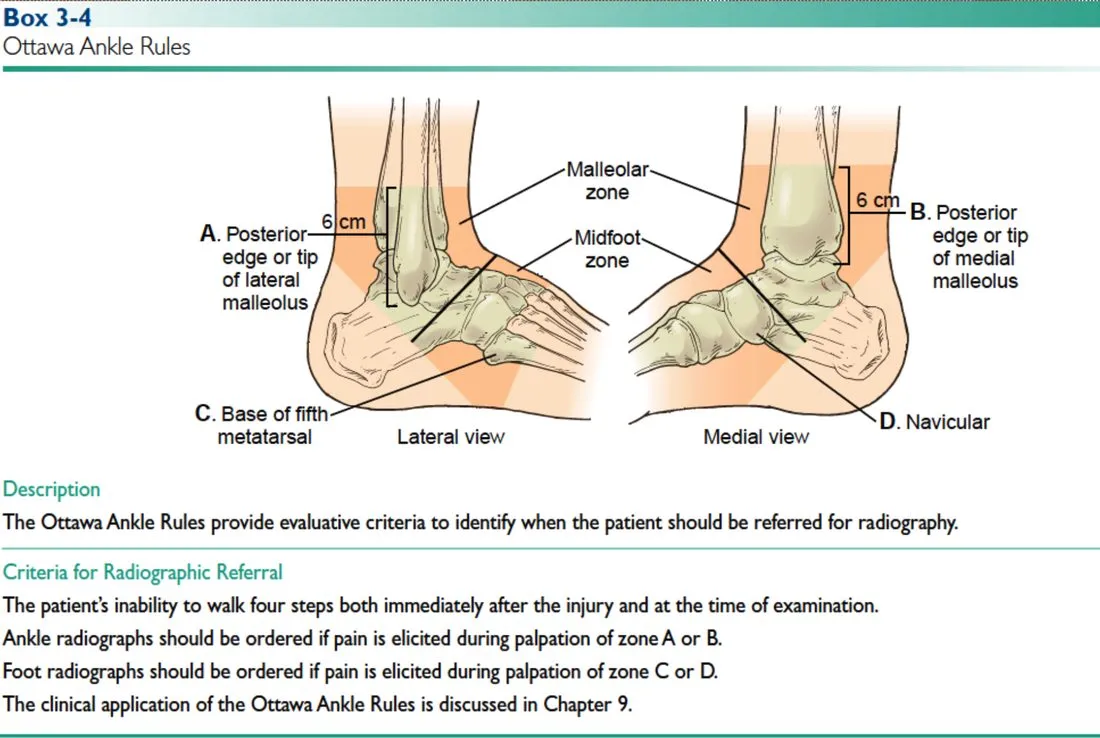 Slide 50 — Ottawa ankle rules, zones A-D