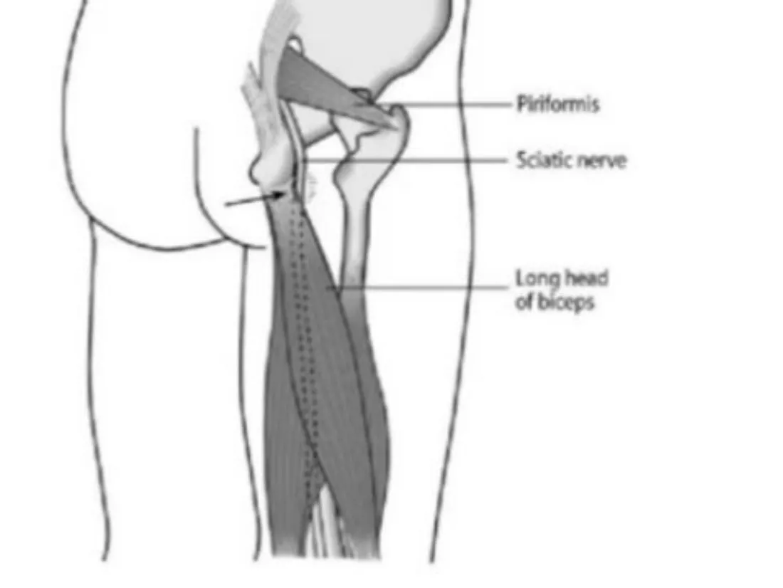 Slide 16 — piriformis, sciatic nerve and long head of biceps