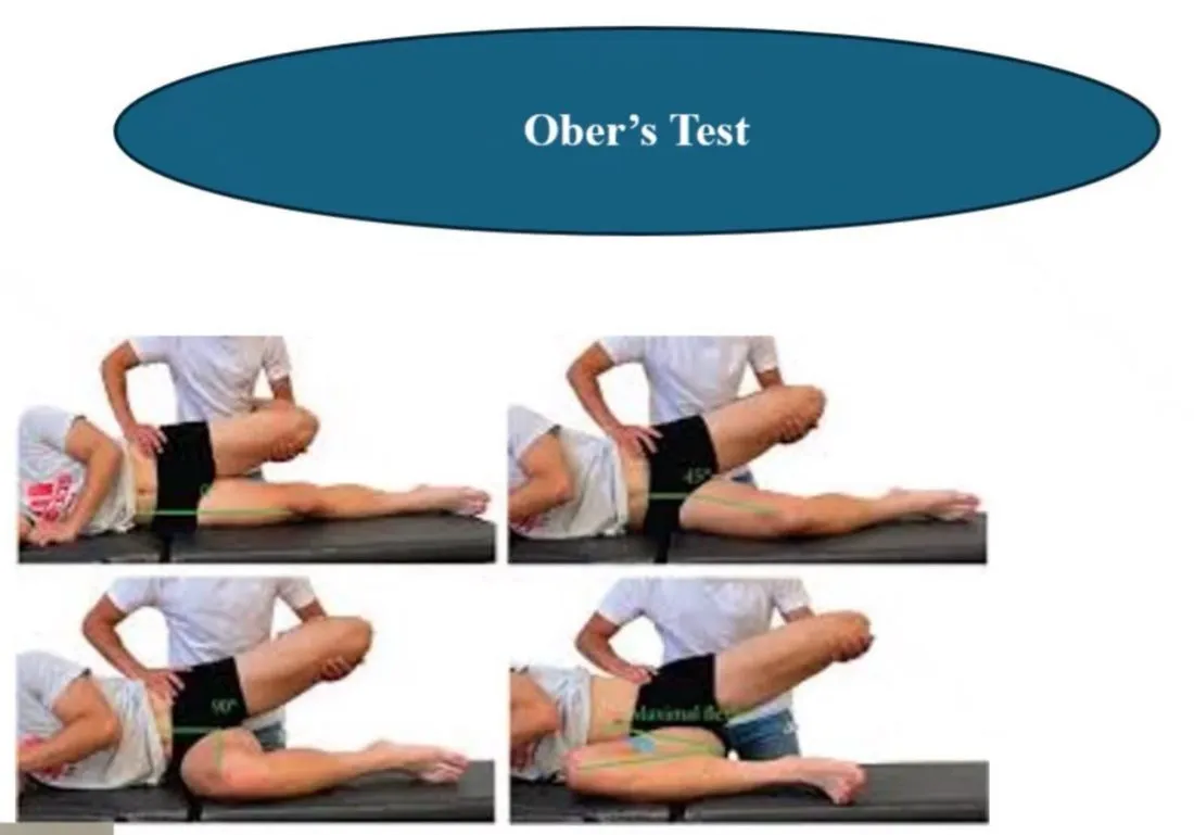 Slide 43 — Ober’s test