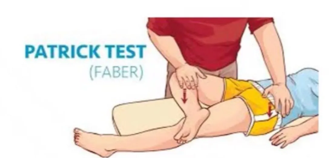 Slide 43 — Patrick test (FABER)
