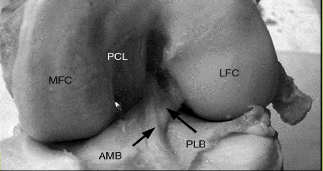 Slide 11 — cadaver knee: MFC, LFC, PCL, AMB, PLB