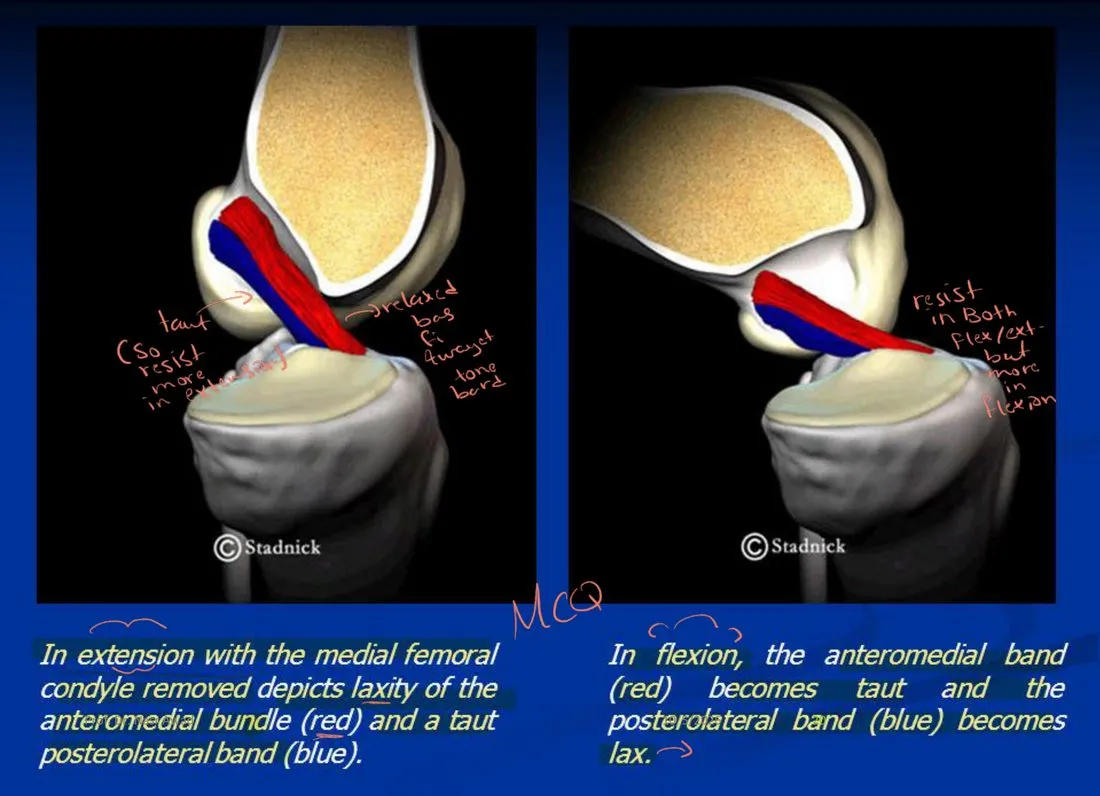 Slide 20 — extension (AMB lax, PLB taut) and flexion (AMB taut, PLB lax)