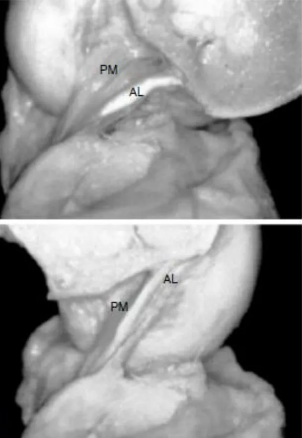 Slide 6 — C: anatomic pictures of the AL and PM bundles