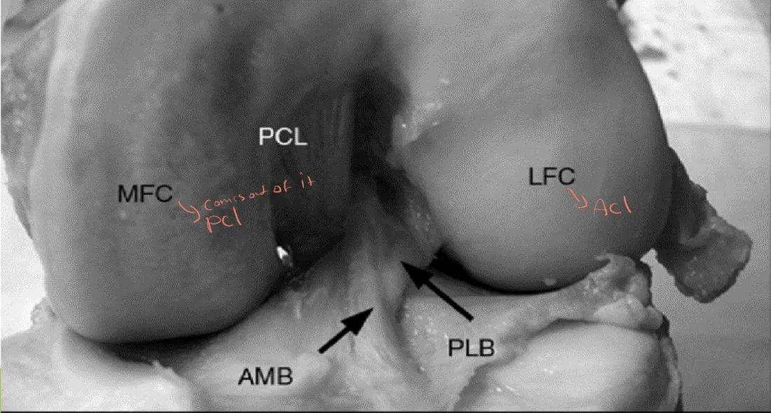 Slide 8 — labelled photo: PCL, MFC, LFC, AMB, PLB