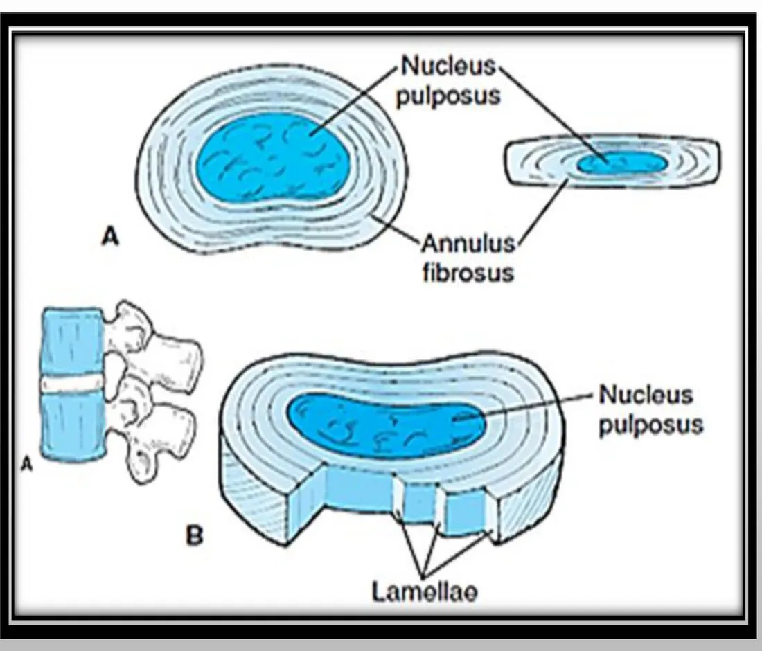 Slide 6 — annulus fibrosus and nucleus pulposus