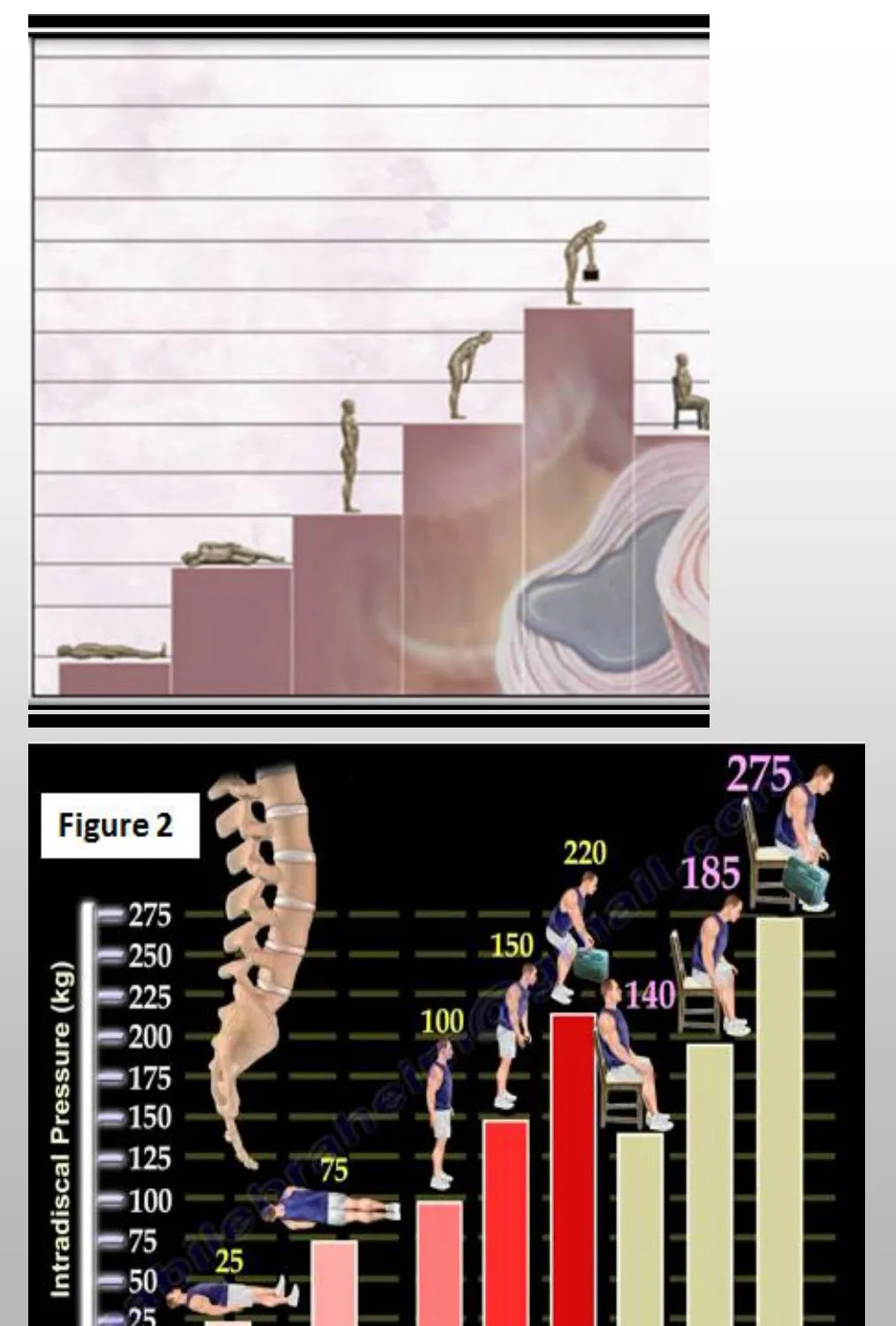Slide 11 — intradiscal pressure by position