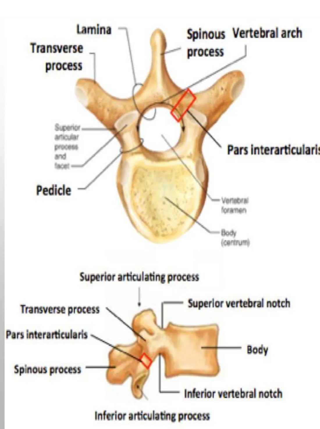 Slide 24 — pars interarticularis