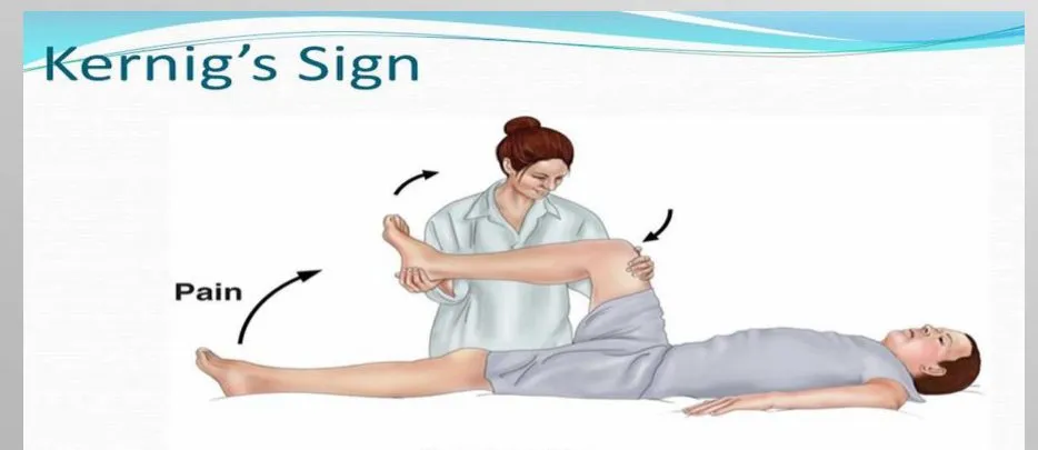 Slide 35 — Kernig’s sign