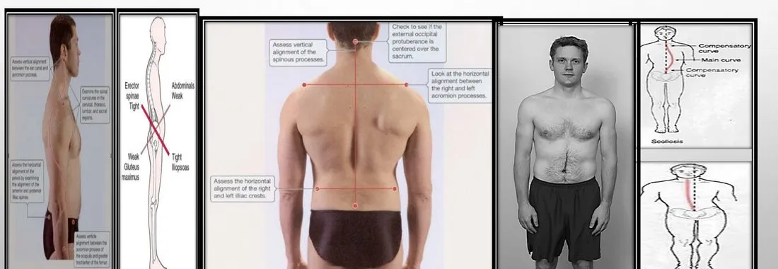 Slide 38 — postural inspection