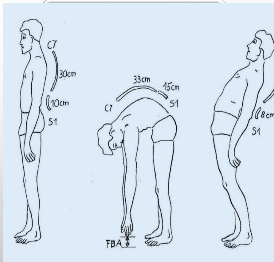 Slide 39 — Schober’s test