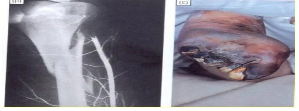 Page 3 — angiogram