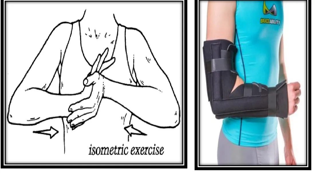 Page 14 — elbow isometrics and splint