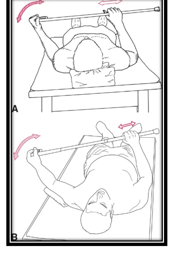 Page 6 — stick ER and abduction