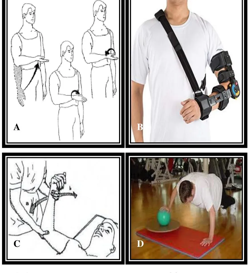 Page 15 — ROM, hinged brace, passive ROM, proprioception