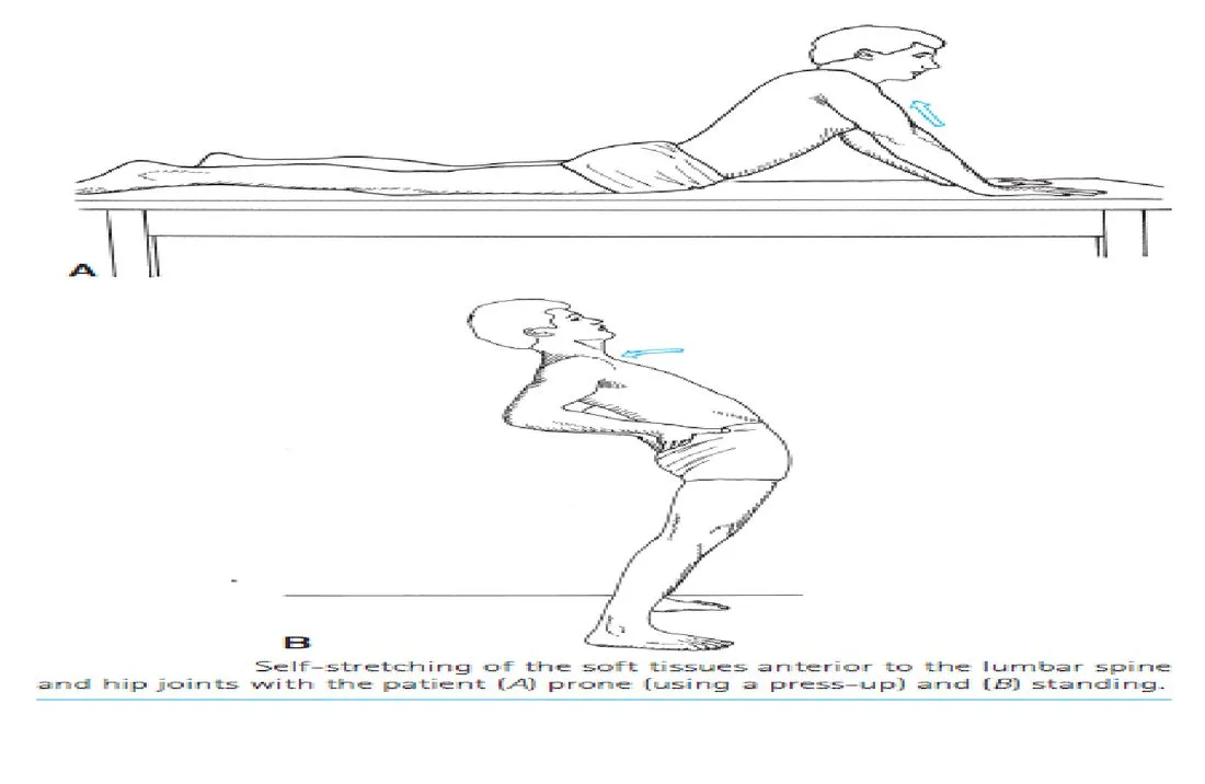 Slide 12 — increasing lumbar extension